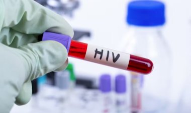 Homem vive mais de seis anos sem sinais do HIV após transplante de células-tronco, indica estudo aceito pela Nature