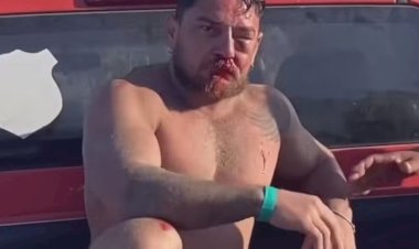 Casal de turistas de Mato Grosso é agredido em Porto de Galinhas após cobrança por uso de cadeiras de praia: 'Eu vi a morte na nossa frente'