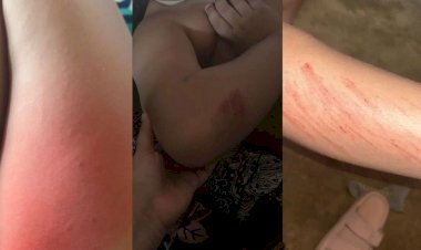 Família denuncia agressão contra criança autista de 7 anos em escola de Campina Grande