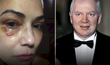 Ex de Luiza Brunet é condenado a pagar R$ 150 mil por agressões contra a modelo