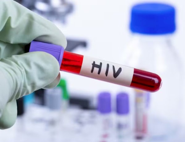 Homem vive mais de seis anos sem sinais do HIV após transplante de células-tronco, indica estudo aceito pela Nature