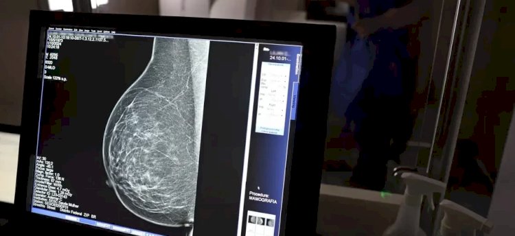 Paraíba recebe medicamento inédito para câncer de mama no SUS