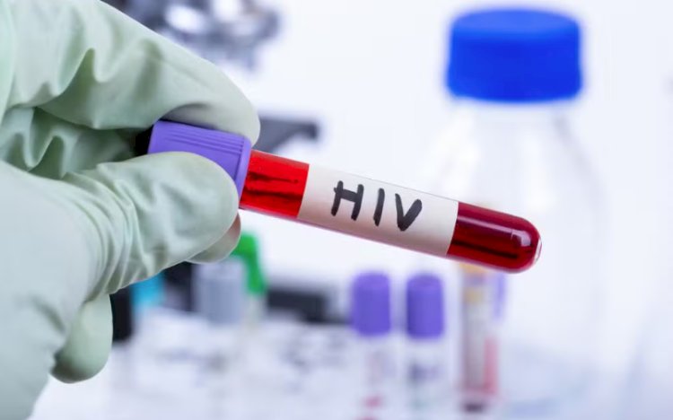 Homem vive mais de seis anos sem sinais do HIV após transplante de células-tronco, indica estudo aceito pela Nature