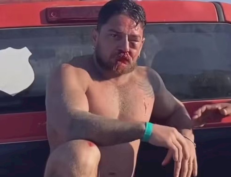 Casal de turistas de Mato Grosso é agredido em Porto de Galinhas após cobrança por uso de cadeiras de praia: 'Eu vi a morte na nossa frente'