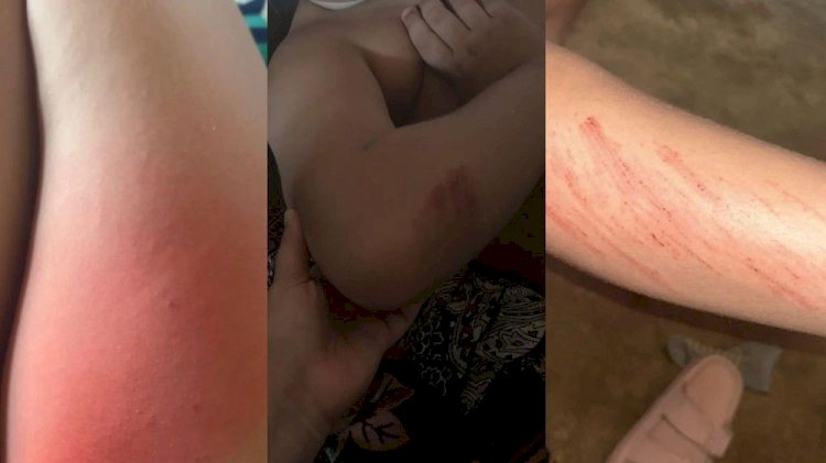 Família denuncia agressão contra criança autista de 7 anos em escola de Campina Grande