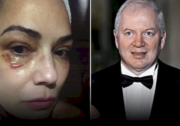 Ex de Luiza Brunet é condenado a pagar R$ 150 mil por agressões contra a modelo